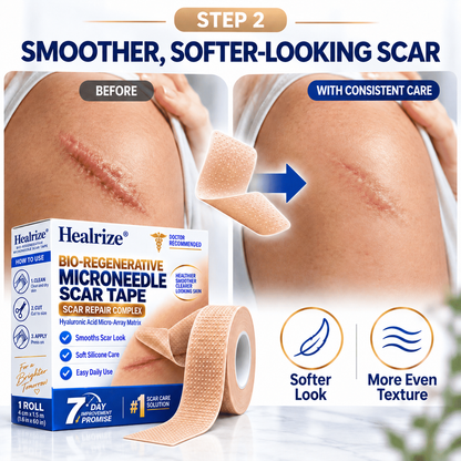 😍Healrize® Bio-Regenerative Microneedle Scar Tape | Helps Flatten, Soften & Smooth Raised Scars | 1.5m Roll