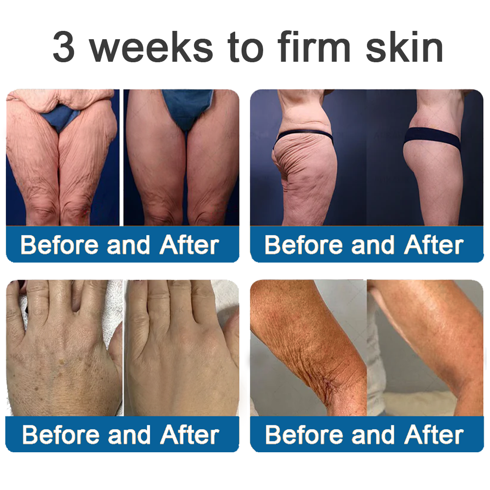 ✨ Official Store | Healrize® Magnesium Firming Body Cream – Deep Hydration for Smoother, Firmer-Looking Skin💝